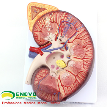 KIDNEY02 (12431) Oversize Plastic Kidney mit Stand 3 Time Vergrößern Life Size Medizinische Anatomie